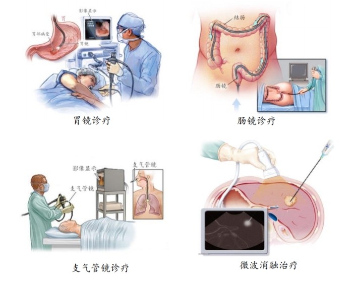 醫(yī)用內(nèi)窺鏡介紹